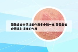 醋酸曲安奈德注射作用多少錢(qián)一支 醋酸曲安奈德注射注液的作用