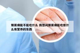 銀屑病能不能吃什么 我想問銀屑病能吃些什么有營養(yǎng)的東西