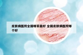皮膚病醫(yī)院全國(guó)哪家最好 全國(guó)皮膚病醫(yī)院哪個(gè)好