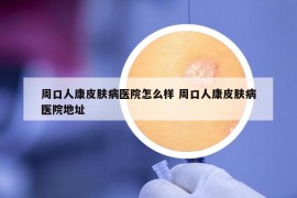 周口人康皮膚病醫(yī)院怎么樣 周口人康皮膚病醫(yī)院地址