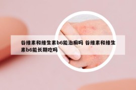 谷維素和維生素b6能治癬嗎 谷維素和維生素b6能長期吃嗎
