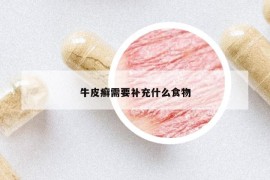 牛皮癬需要補充什么食物