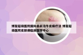 博鰲超級(jí)醫(yī)院國(guó)際最前沿牛皮癬療法 博鰲超級(jí)醫(yī)院皮膚病臨床醫(yī)學(xué)中心