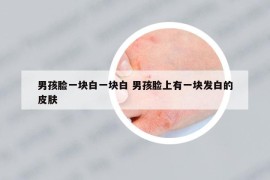 男孩臉一塊白一塊白 男孩臉上有一塊發(fā)白的皮膚