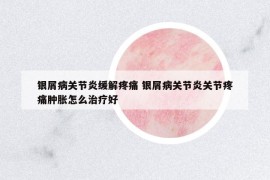 銀屑病關(guān)節(jié)炎緩解疼痛 銀屑病關(guān)節(jié)炎關(guān)節(jié)疼痛腫脹怎么治療好