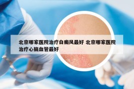 北京哪家醫(yī)院治療白癜風(fēng)最好 北京哪家醫(yī)院治療心腦血管最好