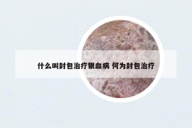 什么叫封包治療銀血病 何為封包治療