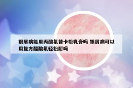 銀屑病能用丙酸氟替卡松乳膏嗎 銀屑病可以用復(fù)方醋酸氟輕松酊嗎