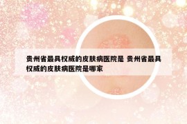 貴州省最具權(quán)威的皮膚病醫(yī)院是 貴州省最具權(quán)威的皮膚病醫(yī)院是哪家