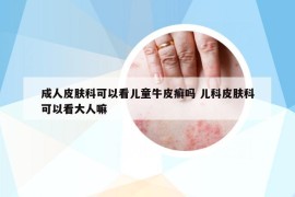 成人皮膚科可以看兒童牛皮癬嗎 兒科皮膚科可以看大人嘛