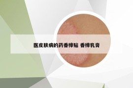 醫(yī)皮膚病的藥香樟貼 香樟乳膏