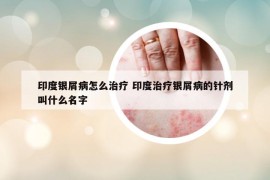 印度銀屑病怎么治療 印度治療銀屑病的針劑叫什么名字