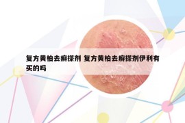 復(fù)方黃柏去癬搽劑 復(fù)方黃柏去癬搽劑伊利有買的嗎