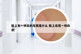 臉上有一塊白的東西是什么 臉上出現(xiàn)一塊白的