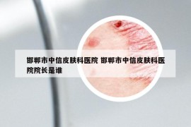 邯鄲市中信皮膚科醫(yī)院 邯鄲市中信皮膚科醫(yī)院院長(zhǎng)是誰(shuí)