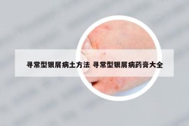 尋常型銀屑病土方法 尋常型銀屑病藥膏大全