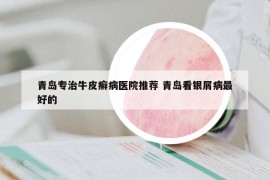 青島專治牛皮癬病醫(yī)院推薦 青島看銀屑病最好的
