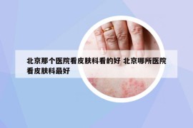 北京那個(gè)醫(yī)院看皮膚科看的好 北京哪所醫(yī)院看皮膚科最好