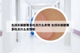 女孩長(zhǎng)癬都要多吃點(diǎn)什么食物 女孩長(zhǎng)癬都要多吃點(diǎn)什么食物呢