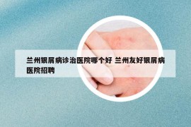 蘭州銀屑病診治醫(yī)院哪個好 蘭州友好銀屑病醫(yī)院招聘