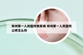 鄭州第一人民醫(yī)院銀屑病 鄭州第一人民醫(yī)院口碑怎么樣