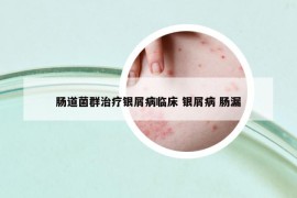 腸道菌群治療銀屑病臨床 銀屑病 腸漏