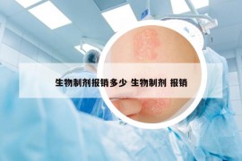 生物制劑報(bào)銷多少 生物制劑 報(bào)銷