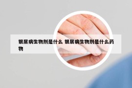 銀屑病生物劑是什么 銀屑病生物劑是什么藥物
