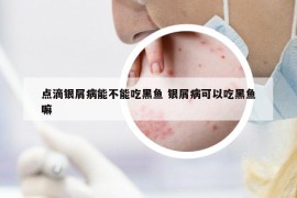 點(diǎn)滴銀屑病能不能吃黑魚 銀屑病可以吃黑魚嘛