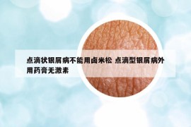 點滴狀銀屑病不能用鹵米松 點滴型銀屑病外用藥膏無激素