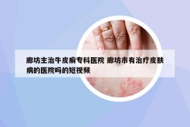 廊坊主治牛皮癬?？漆t(yī)院 廊坊市有治療皮膚病的醫(yī)院嗎的短視頻