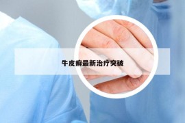 牛皮癬最新治療突破