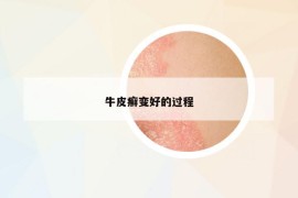 牛皮癬變好的過程