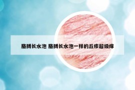 胳膊長(zhǎng)水泡 胳膊長(zhǎng)水泡一樣的丘疹超級(jí)癢