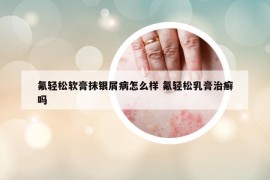 氟輕松軟膏抹銀屑病怎么樣 氟輕松乳膏治癬嗎