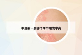 牛皮癬一般哪個(gè)季節(jié)爆發(fā)率高