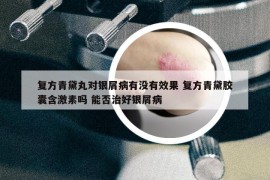 復(fù)方青黛丸對(duì)銀屑病有沒(méi)有效果 復(fù)方青黛膠囊含激素嗎 能否治好銀屑病