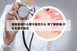 有銀屑病什么都不能吃什么 得了銀屑病,什么東西不能吃