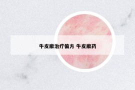 牛皮廨治療偏方 牛皮廨藥