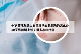 十歲男孩左腿上有很多塊白色斑塊的怎么辦 10歲男孩腿上長了很多小紅疙瘩