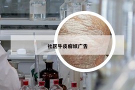社區(qū)牛皮癬紙廣告