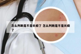 怎么判斷是不是長(zhǎng)癬了 怎么判斷是不是長(zhǎng)癬了