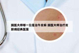 國醫(yī)大師哪一位是治牛皮癬 國醫(yī)大師治療皮膚病經(jīng)典醫(yī)案