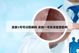 皮膚1號可以擦癬嗎 皮膚一號乳膏能擦臉嗎