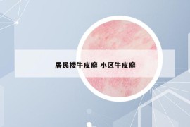居民樓牛皮癬 小區(qū)牛皮癬