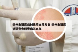 鄭州市銀屑病bi找周文敬專業(yè) 鄭州市銀屑病研究會(huì)所看病怎么樣