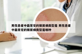 男性患者中最常見(jiàn)的銀屑病類(lèi)型是 男性患者中最常見(jiàn)的銀屑病類(lèi)型是哪種
