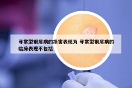 尋常型銀屑病的損害表現(xiàn)為 尋常型銀屑病的臨床表現(xiàn)不包括