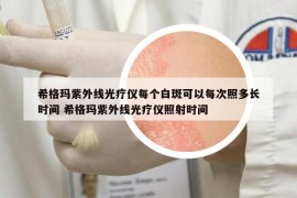 希格瑪紫外線光療儀每個白斑可以每次照多長時間 希格瑪紫外線光療儀照射時間