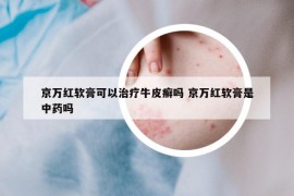 京萬紅軟膏可以治療牛皮癬嗎 京萬紅軟膏是中藥嗎